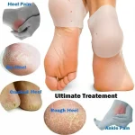 Heel Protectors, Gel Heel Pads, Silicone Socks for Pain Relief, Cracked Heel, Blister Prevention Heel, Plantar Fascitis Cushions - Image 3