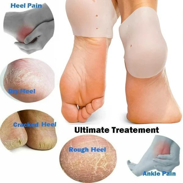 Heel Protectors, Gel Heel Pads, Silicone Socks for Pain Relief, Cracked Heel, Blister Prevention Heel, Plantar Fascitis Cushions - Image 3