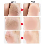 Heel Protective Socks