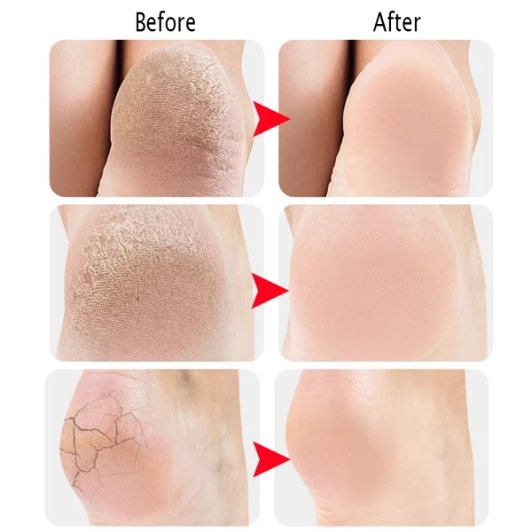 Heel Protective Socks